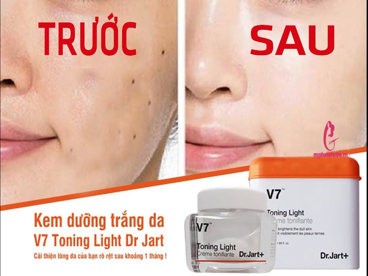 Kem Trắng da V7 Hàn Quốc 50ml