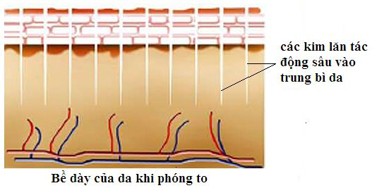 kim lăn trị sẹo zgts 540