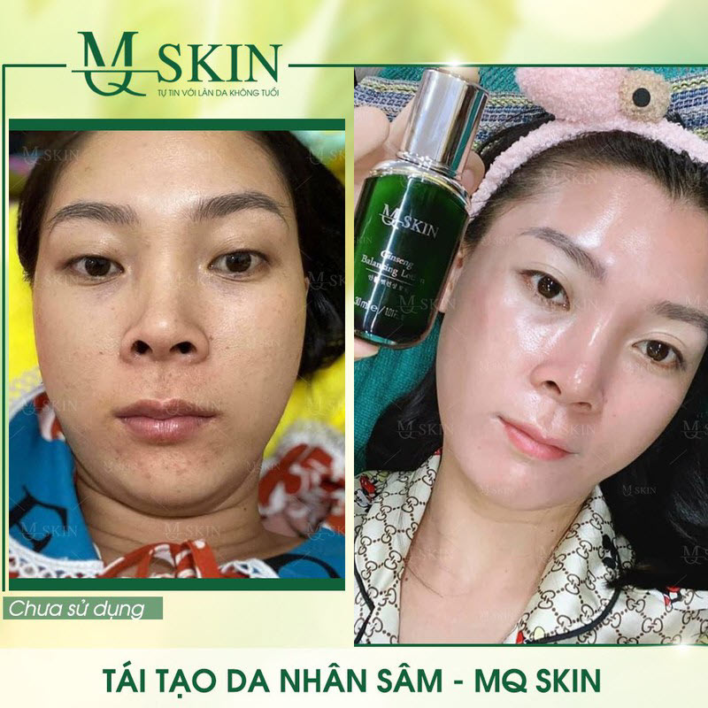 BB cream nhân sâm Mq Skin Tái Tạo Da Makeup