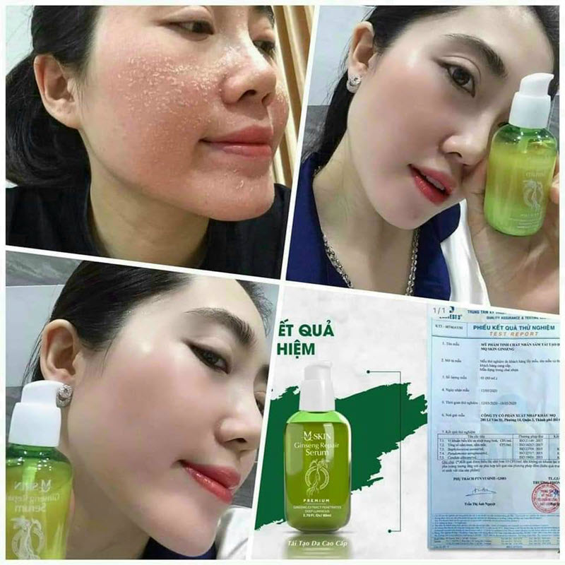 Serum tái tạo thay da cao cấp Mq Skin Vip