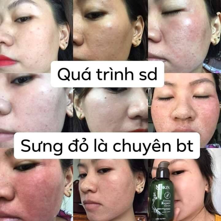 Serum Thay da nhân sâm MQSkin