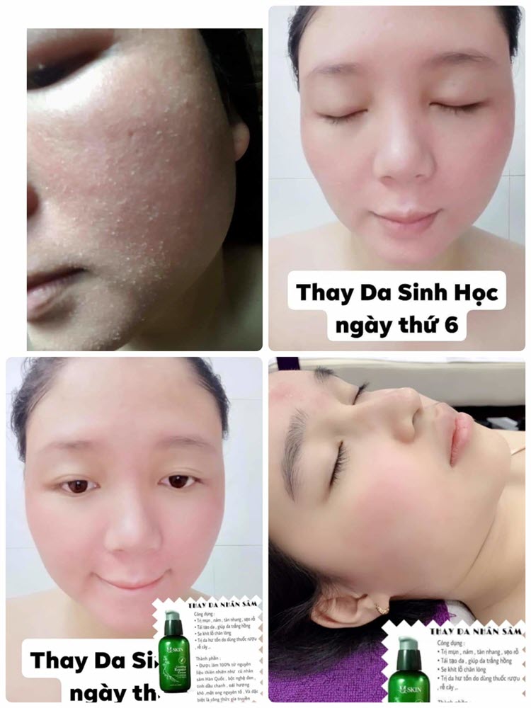 Serum Thay da nhân sâm MQSkin