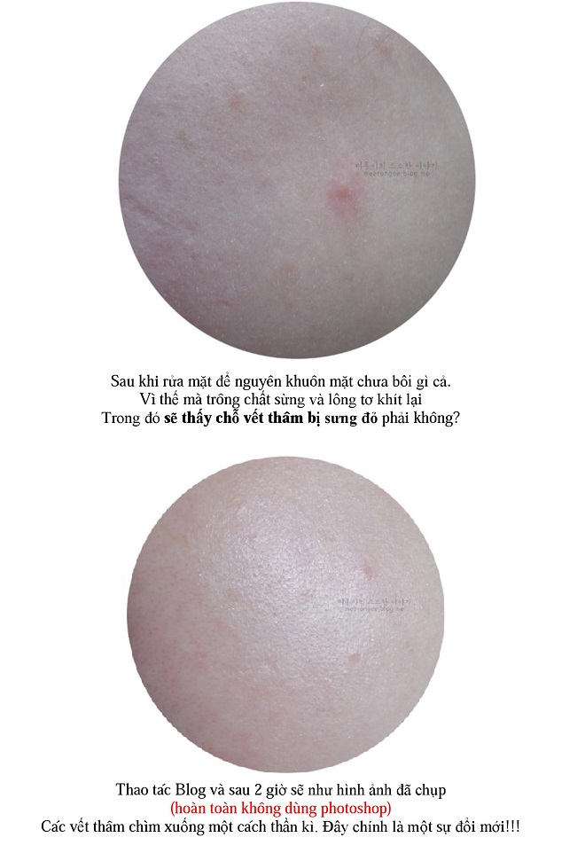 serum skinaz AC Bảo vệ da và kiểm soát da nhòn
